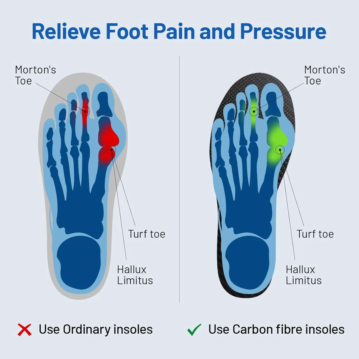 Carbon Fiber Insole 1 Piece, FAKILO Carbon Fiber Foot Plate Shoes Insert for Women Men, Rigid Support for Hallux Rigidus, Turf Toe, Foot Fractures, Mortons Toe - 233mm